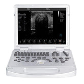 Portable ultrasound scanner with color Doppler convex probe and screen for 128 elements